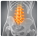 Lumbar Spine 